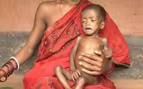 କୋଟି କୋଟି ଟଙ୍କା ଖର୍ଚ୍ଚ ହେଲା ପରେ ବି ରାଜ୍ୟରେ ଅପପୁଷ୍ଟିର ଭୟାବହ ଚିତ୍ର